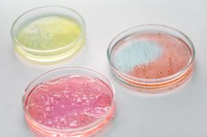 Petri dishes to represent bacteria for gut health